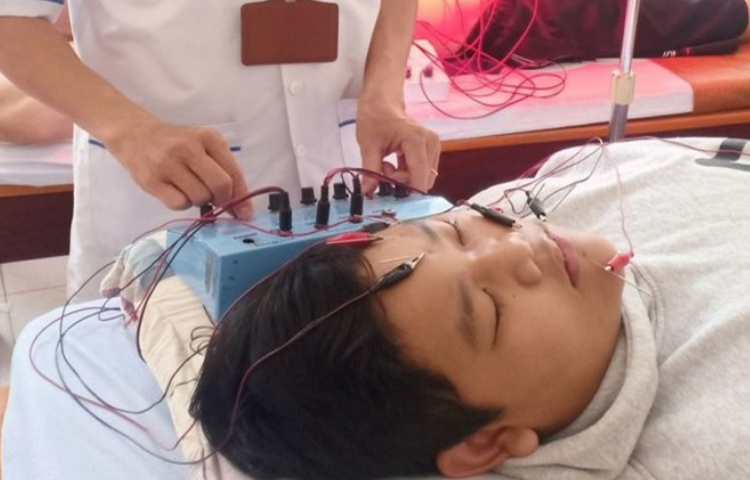 Điện châm điều trị viêm mũi xoang (Tỵ uyên) (Viêm mũi; Viêm xoang cấp; Viêm xoang mạn)